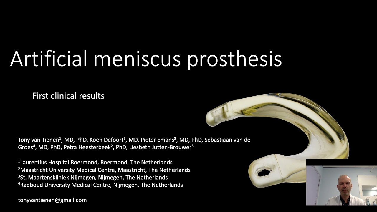 Clinical Experiences With an Anatomical Shaped Artificial Medial Meniscus Prothesis for the Knee