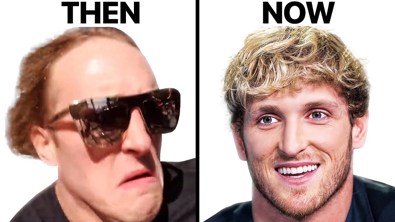 Logan Paul's Hair Regrowth | Surgeon Reacts