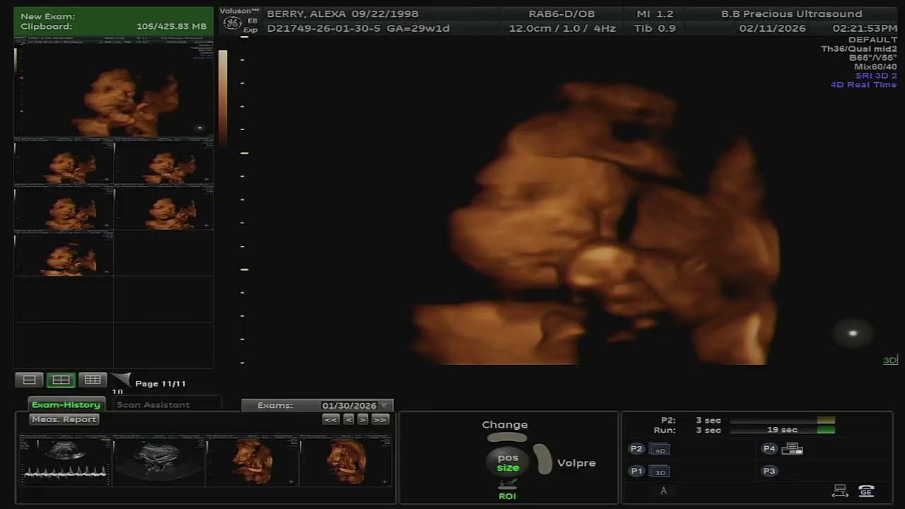 BB Precious Live Stream