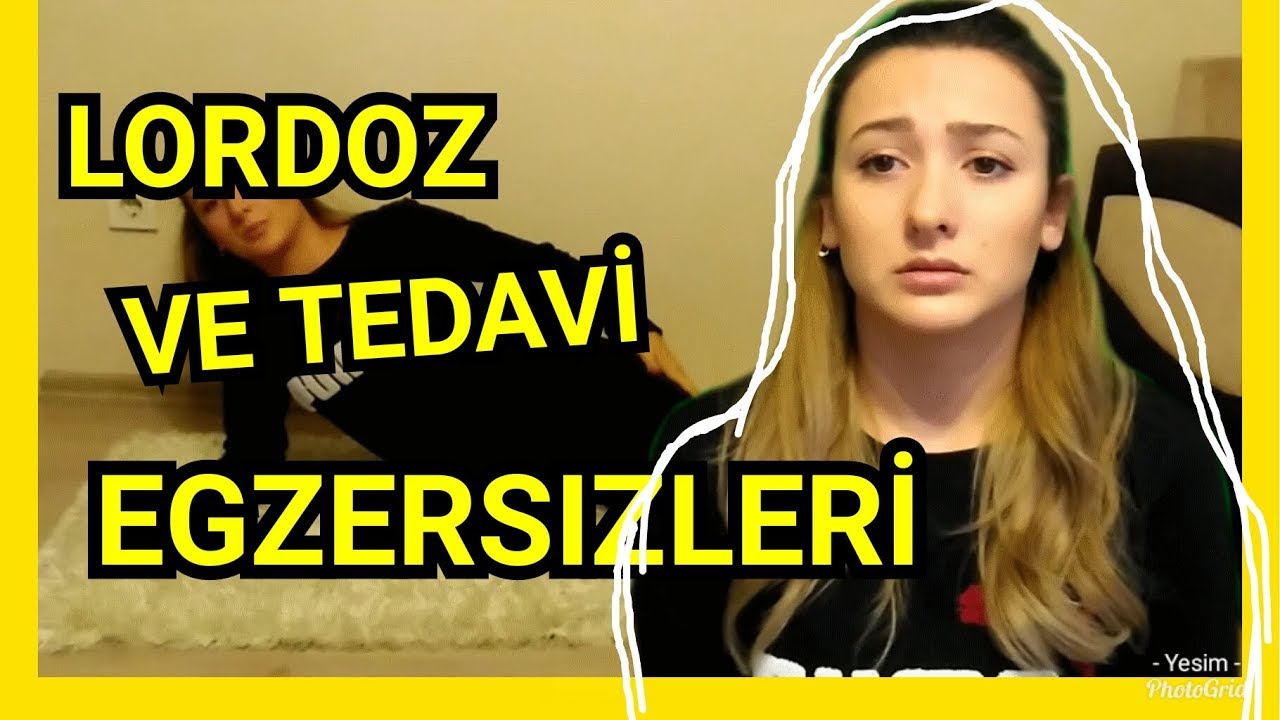 LORDOTİK POSTÜR | TEDAVİ EGZERSİZLERİ | LORDOZ