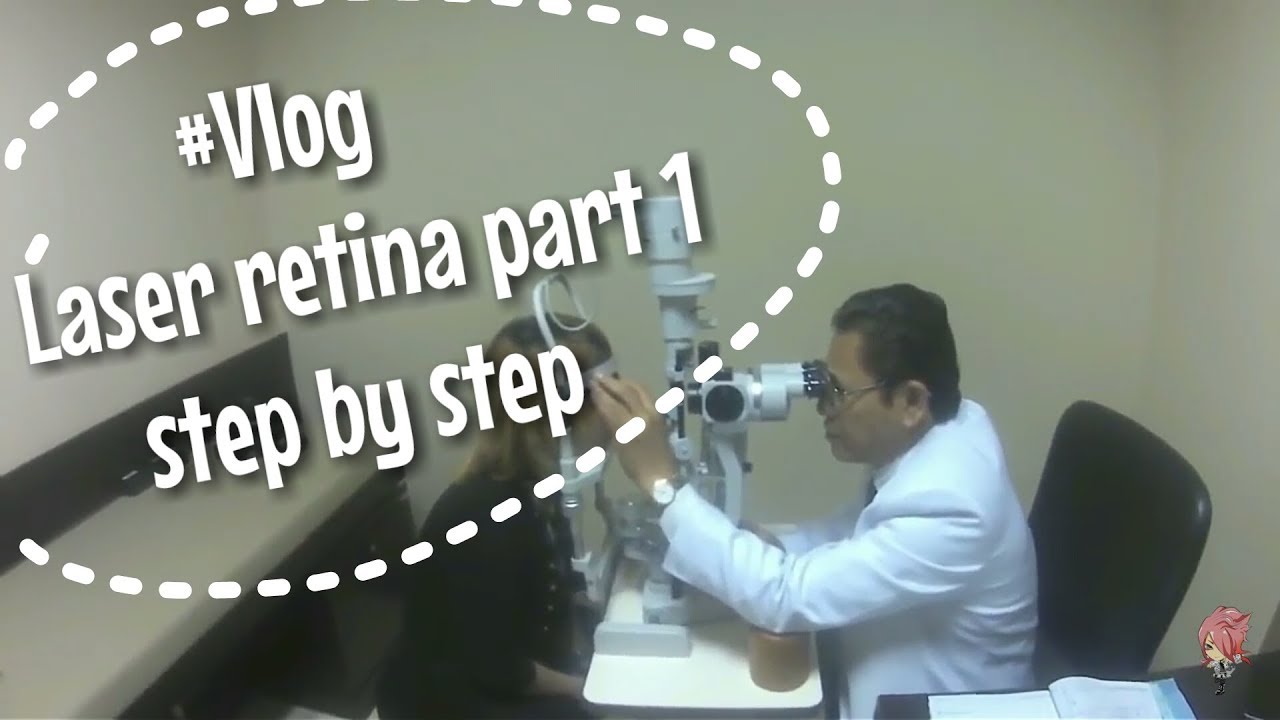 Step by Step Laser Retina (LAGI) di RS Mata Cicendo Part 1  ［VLOG］#RetinalDetachmentStory 01