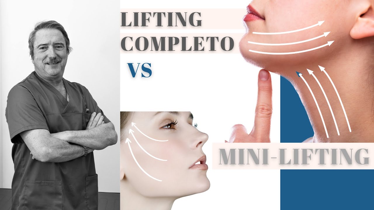 Lifting completo VS Mini-lifting