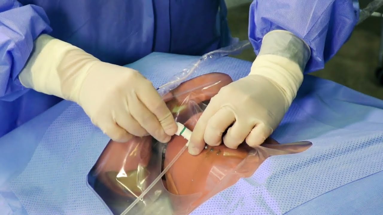 How to perform Transvenous Pacing using the MedStar TVP Kit