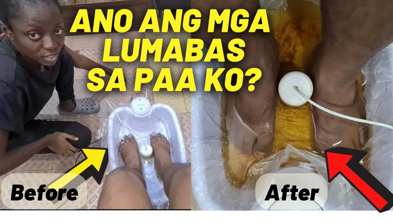 Nagulat nalang ako sa mga lumalabas sa paa ko! #footdetox #ionicfootdetox