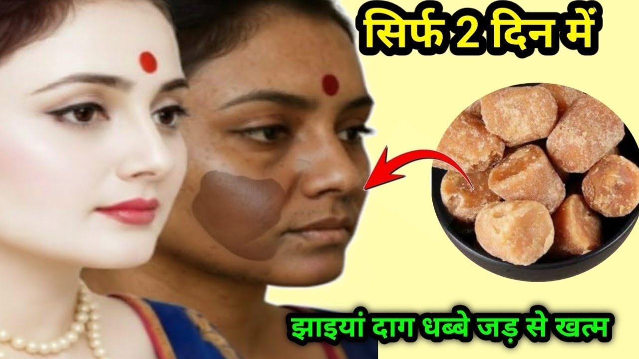 दो बूंद लगते ही मेरा चेहरा शीशे की तरह चमकने लगा👉10 साल पुरानी झाइयां काले दाग धब्बे सब साफ हो गए🙈