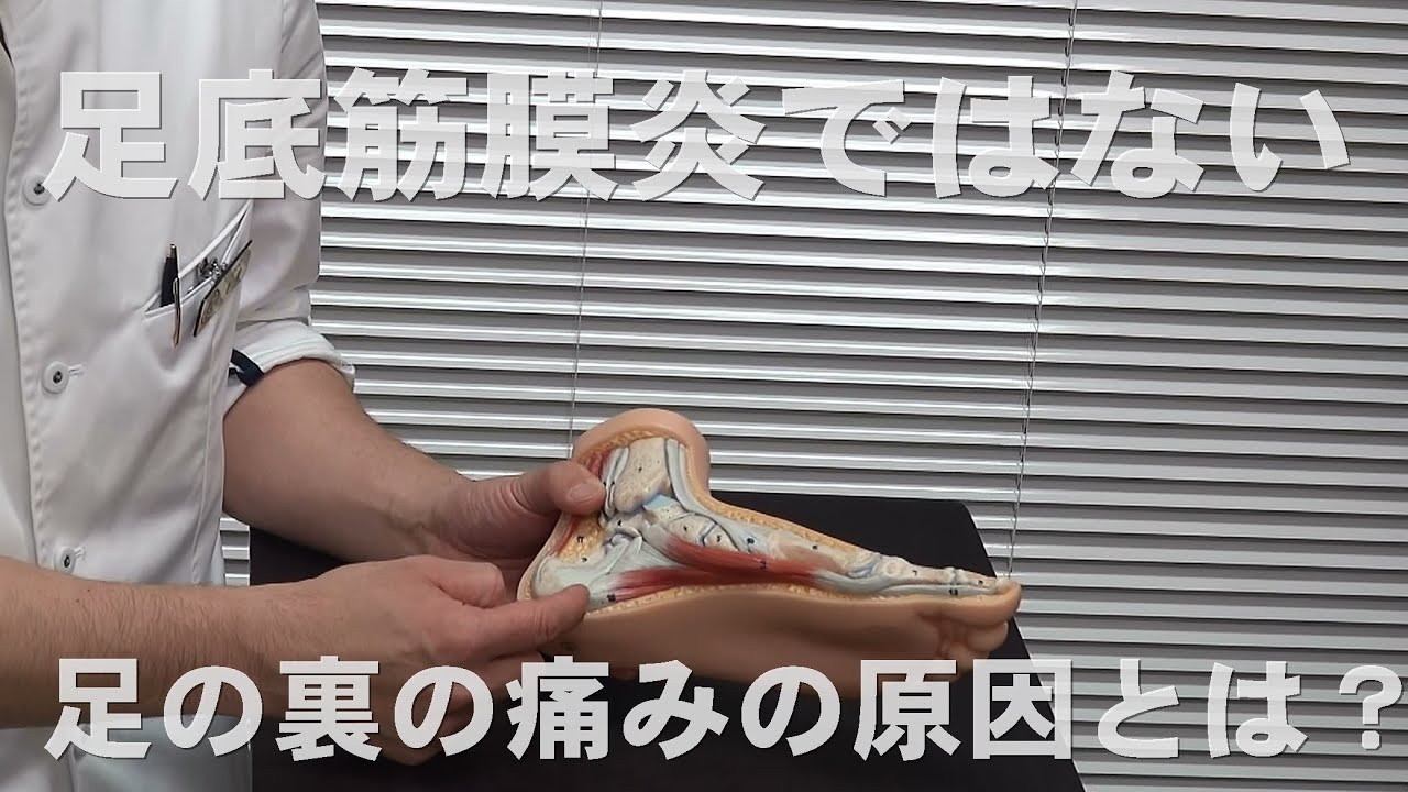 足底筋膜炎ではない足の裏の痛み