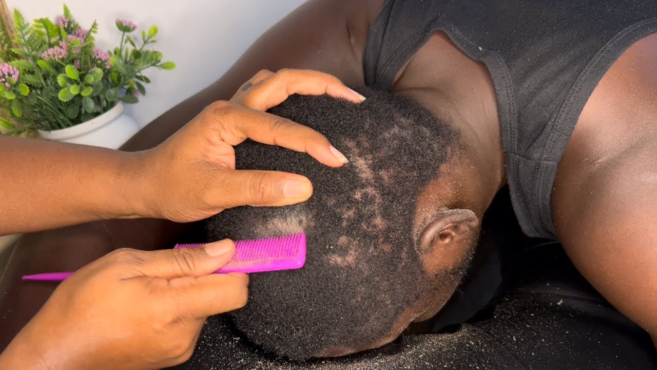 ASMR dandruff scratching #asmr #asmrscalpcheck #asmrdandruff