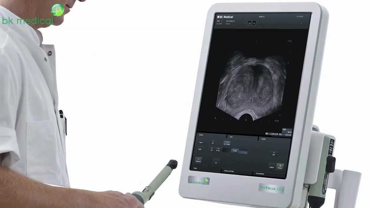 Market Leaders in Prostate Imaging Technology
