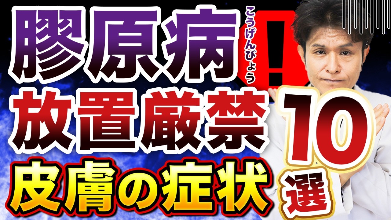 膠原病の初期症状は“肌”に出る？皮膚病変10選【専門医が徹底解説】