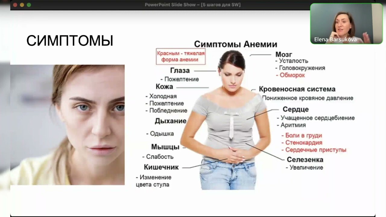 5 ШАГОВ ЛЕЧЕНИЯ АНЕМИИ