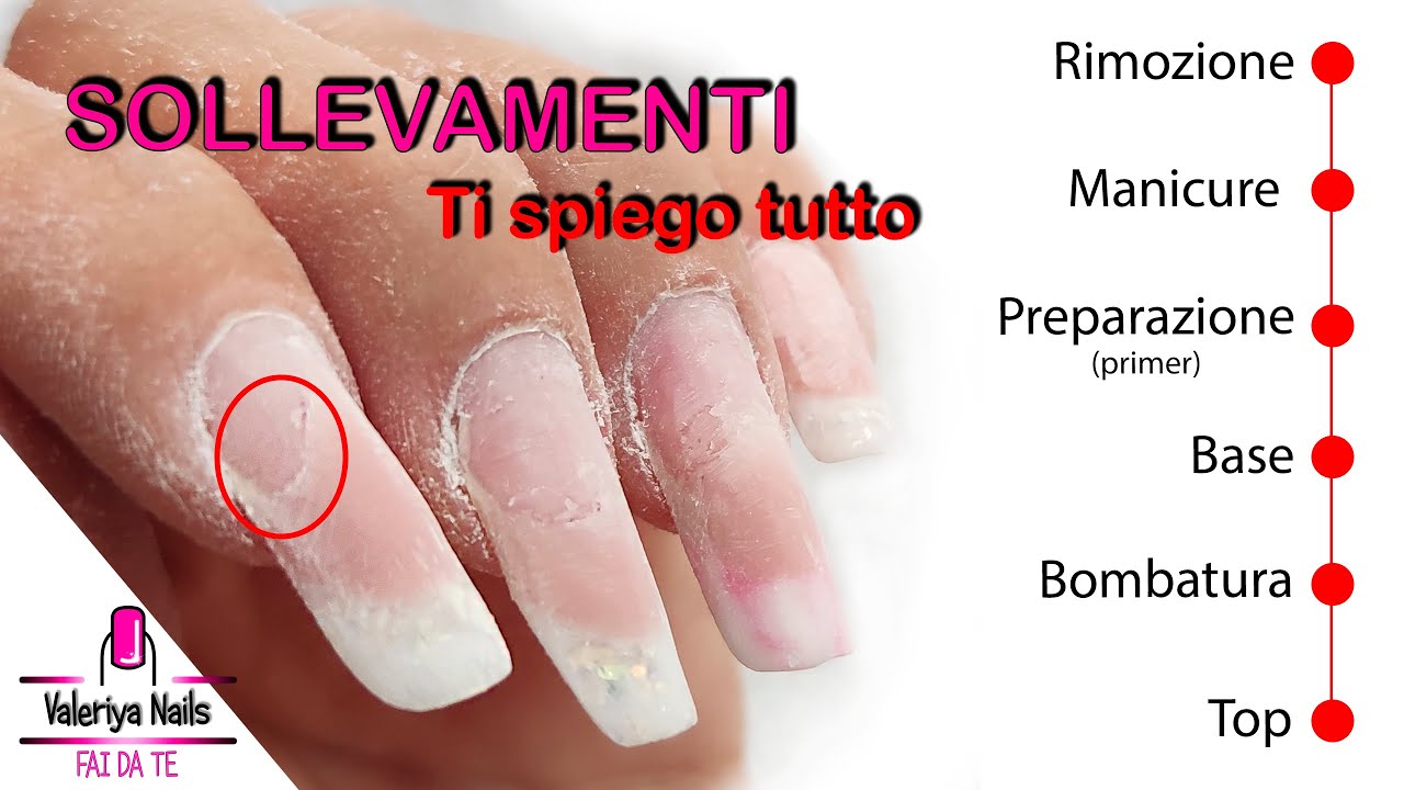 Tutte le cause dei Sollevamenti unghie in ogni passaggio