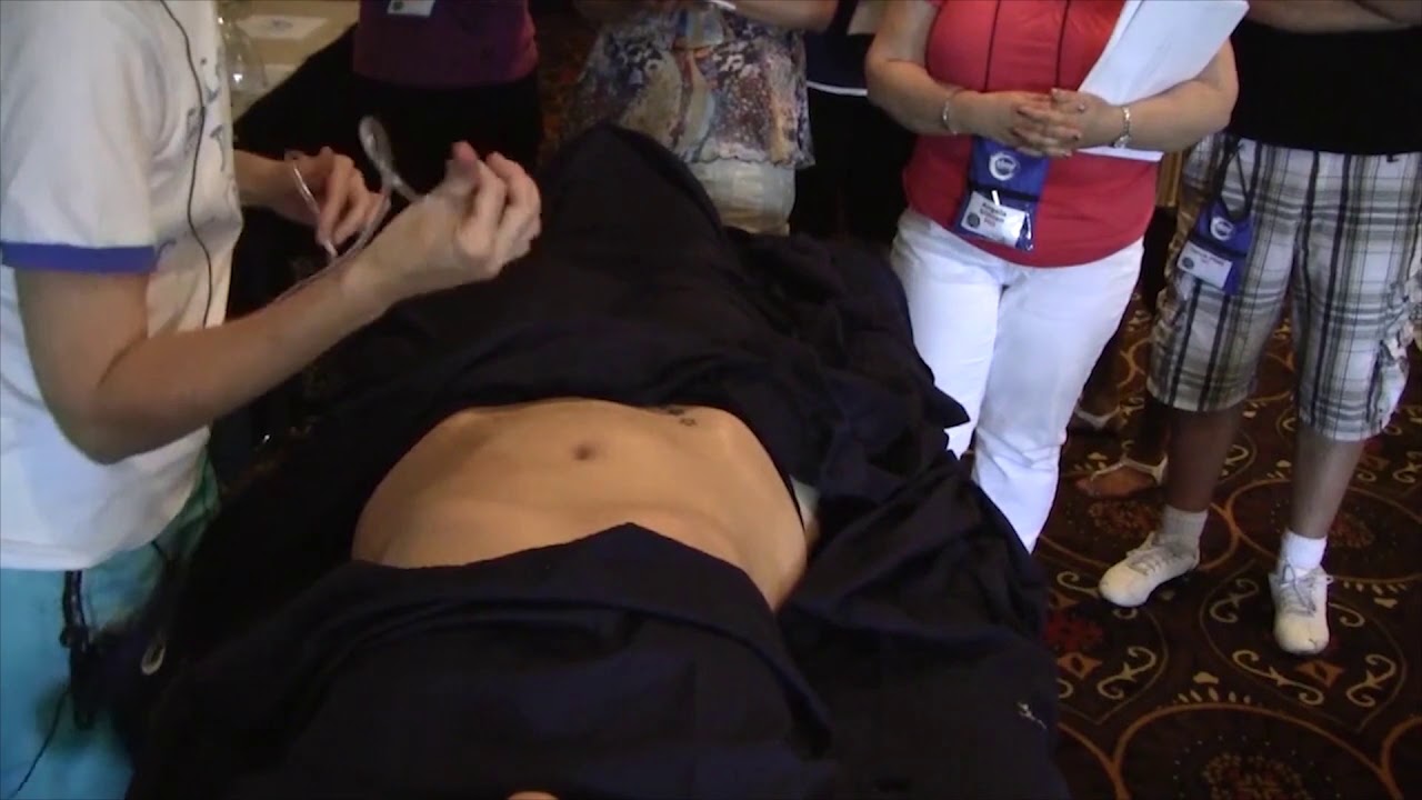 Addressing Abdominal Issues with ACE Massage Cupping Therapy - Cupping Therapy Workshop Demo Part 13