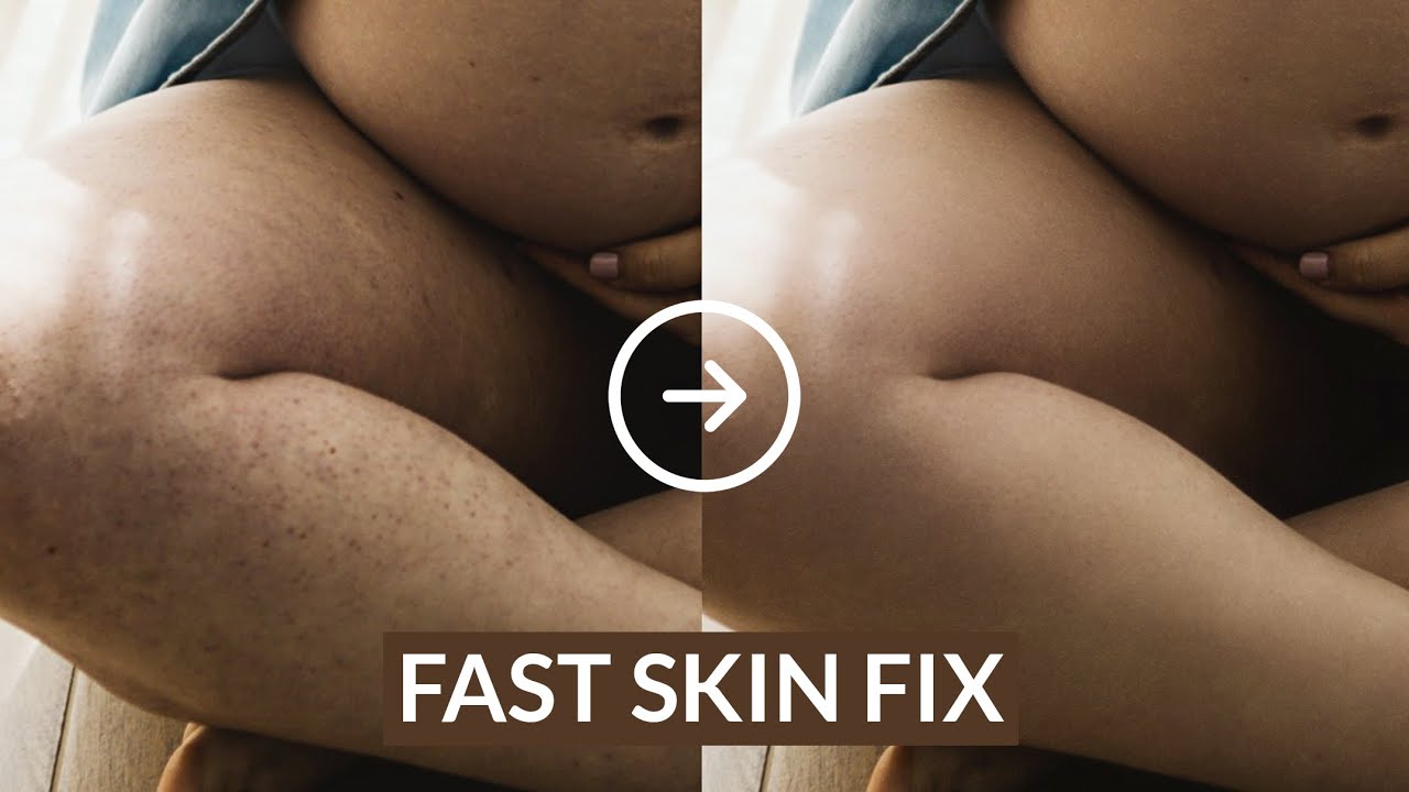 Fast Skin Fix: 5 Minute Skin Retouching Workflow