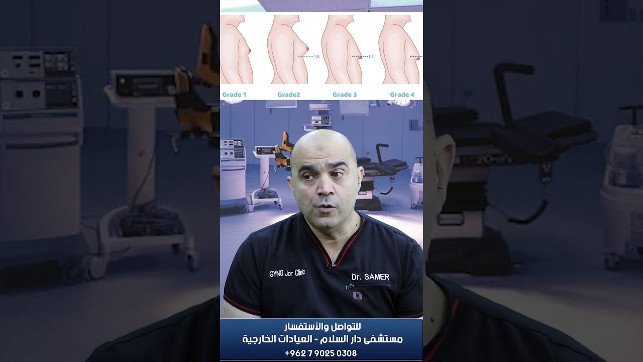 شد ترهلات الصدر عند الرجال الدرجة الثاثة و الدرجة الرابعة ترهلات