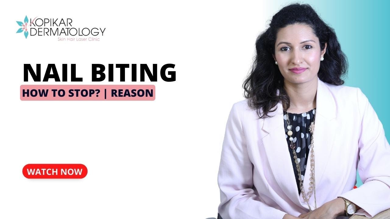Nail Biting: Why it happens  & Effective Solutions