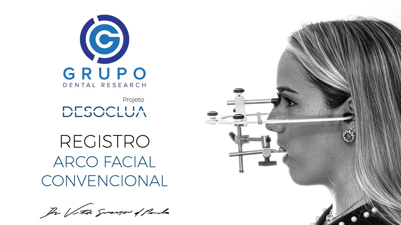 🦷 Como Fazer o Registro com o Arco Facial Standard da Bioart — Passo a Passo clínico | DESOCLUA