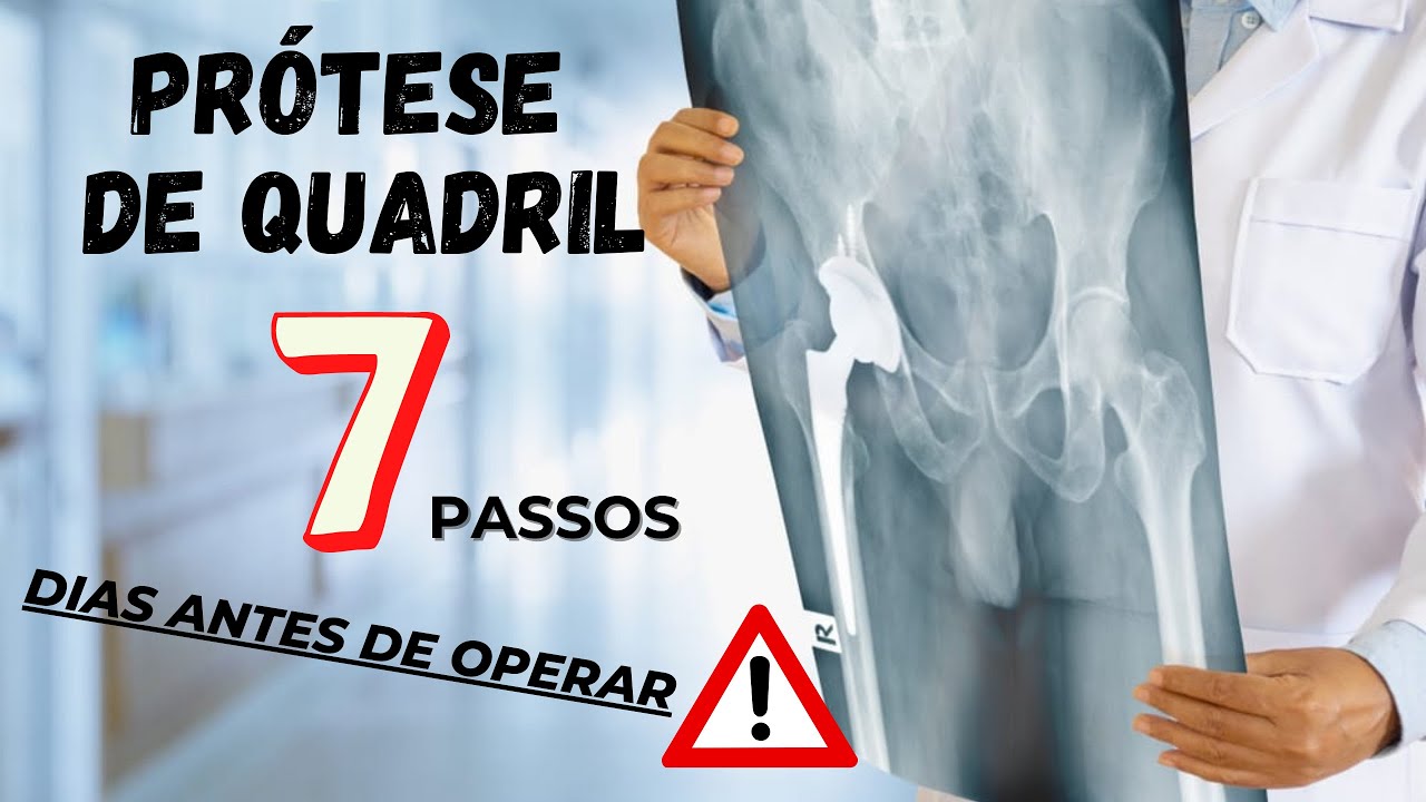 ANTES da PRÓTESE DE QUADRIL - O que VOCÊ deve fazer?