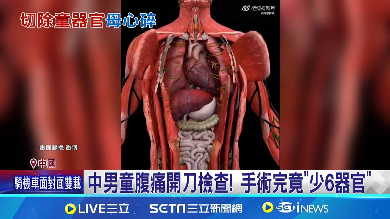 手術長達14小時 醫生要求家屬簽同意書 中男童腹痛開刀檢查! 手術完竟