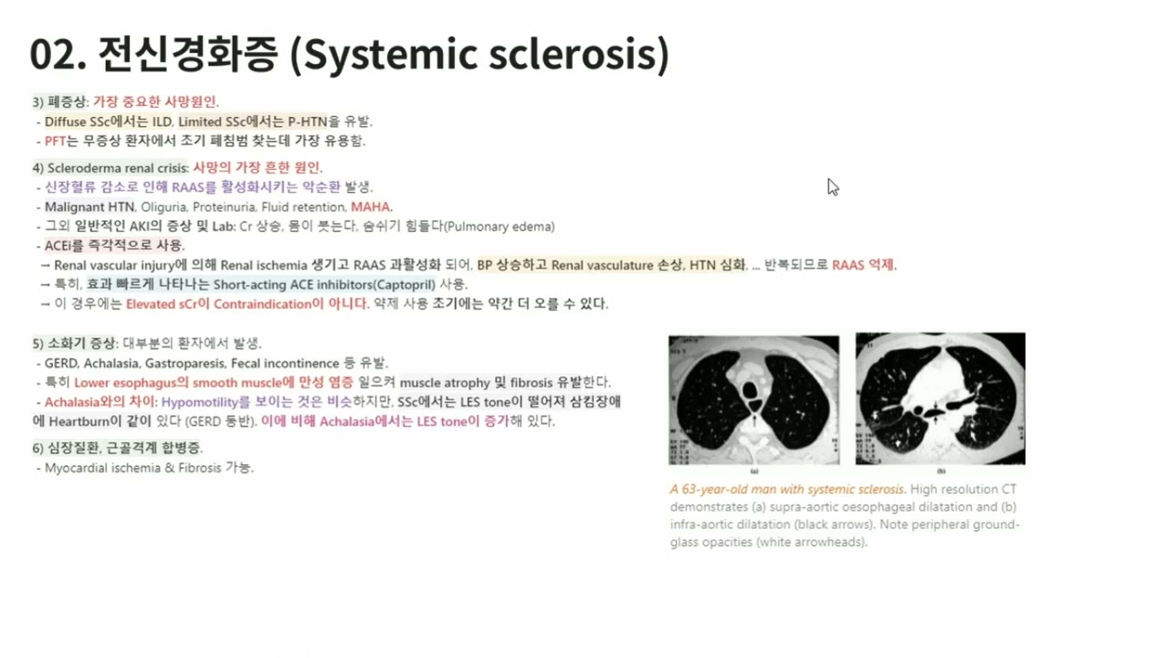 MLE 강의 시리즈 -  Rheumatology, 3) 전신경화증