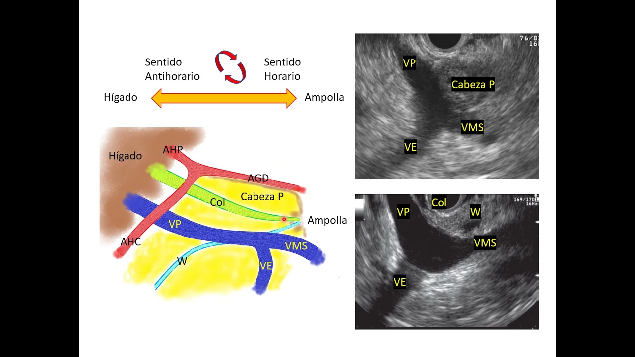 Anatomía hepato-bilio-pancreática aplicada a la ecoendoscopía.