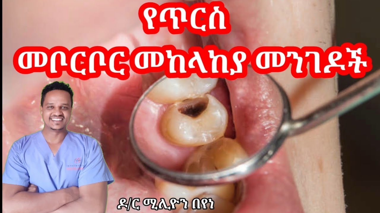የጥርስ መቦርቦርን የምንከላከልባቸው ቀላል መንገዶች/ prevent dental caries/@ዶርሚሊዮንDrMillion