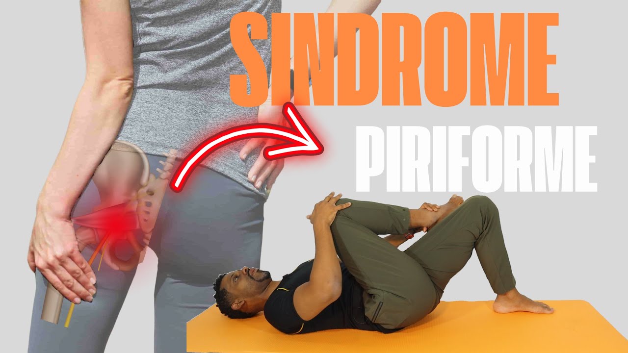 DOR NO NERVO CIÁTICO? Pode ser SÍNDROME DO PIRIFORME! Faça Essa Sequência de Exercícios Agora!