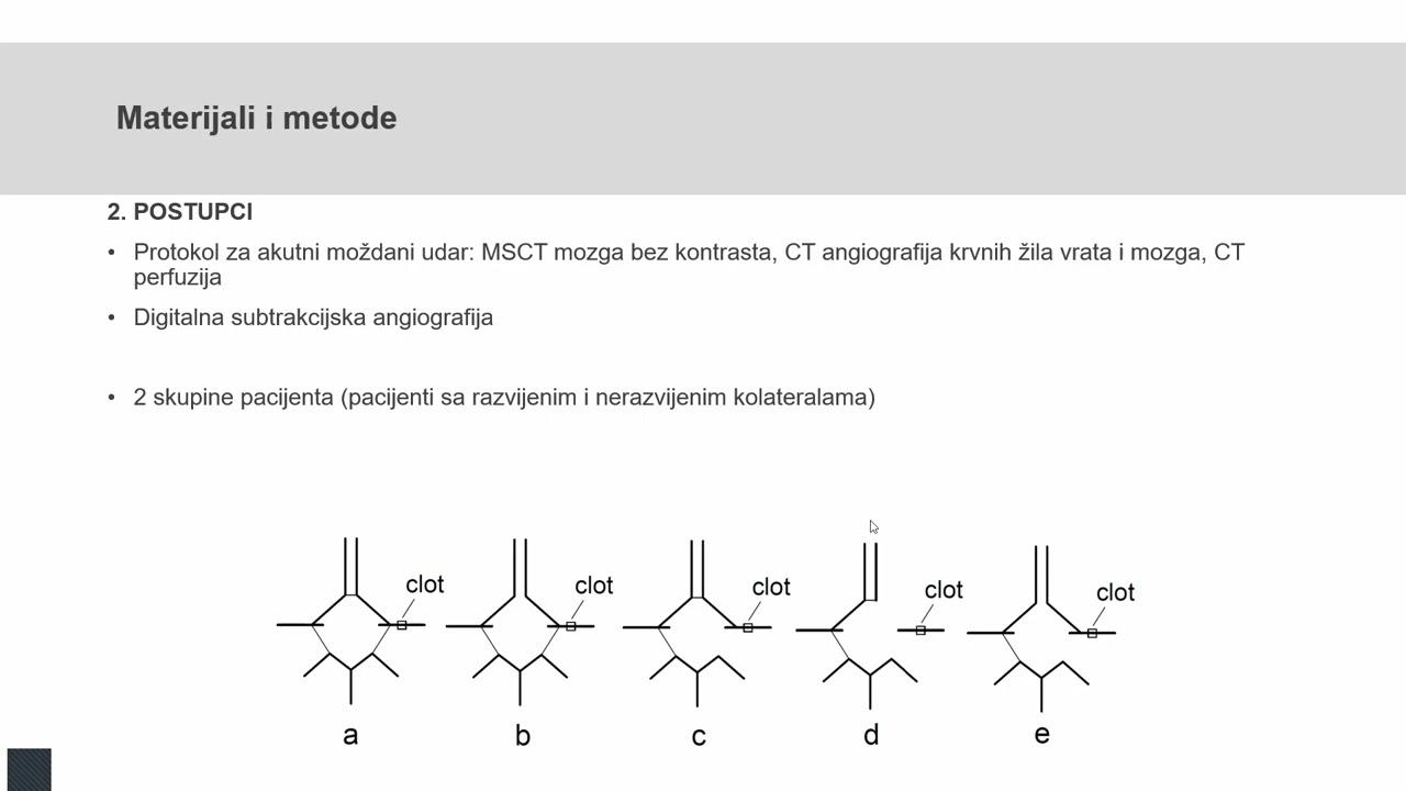 Sablic moždani udar
