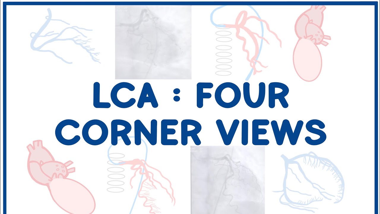 Left Coronary Artery Angiogram: The Four Corners Overview