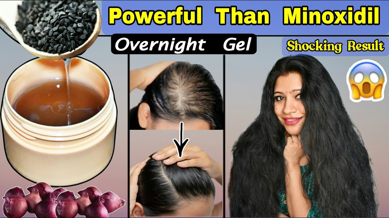 Minoxidil Gel:Do Not Wash This Gel Keep Overnight To Regrow Hair & To Make Hair Black & Thick
