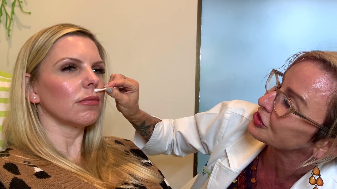 The Anatomy of the Lips and how to treat with Botox and Dermal Filler