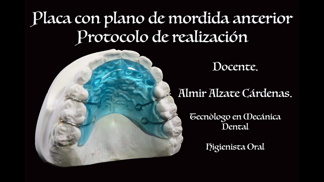 Placa con plano de mordida anterior