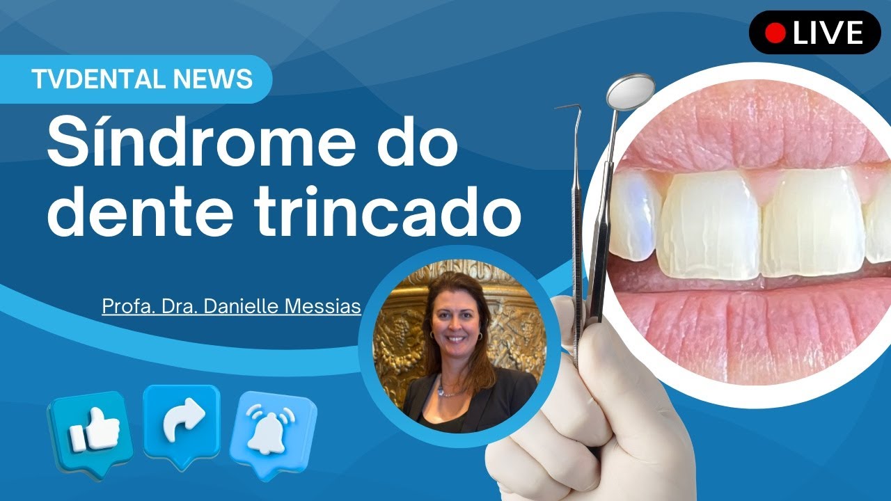 Síndrome do dente trincado: desafios na identificação e manejo clínico