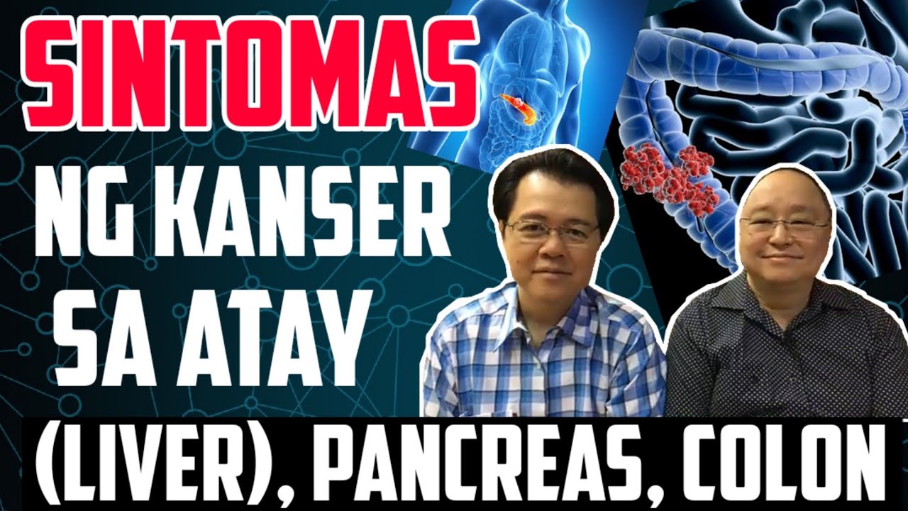 Sintomas ng Kanser sa Atay, Lapay, Colon Cancer - Payo ni Doc Willie Ong #170