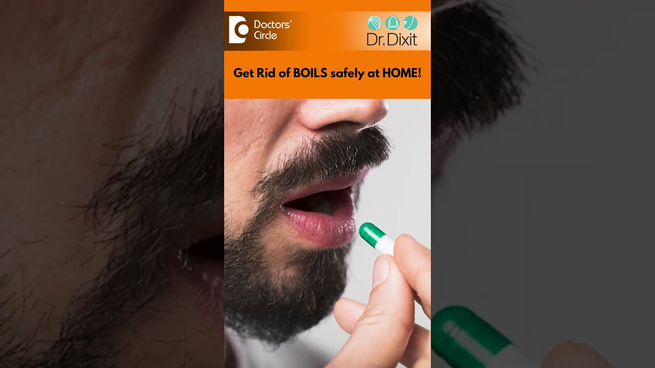 How to TREAT BOILS AT HOME? | Painful Boils on Buttocks | Heat Boils - Dr. Rasya Dixit
