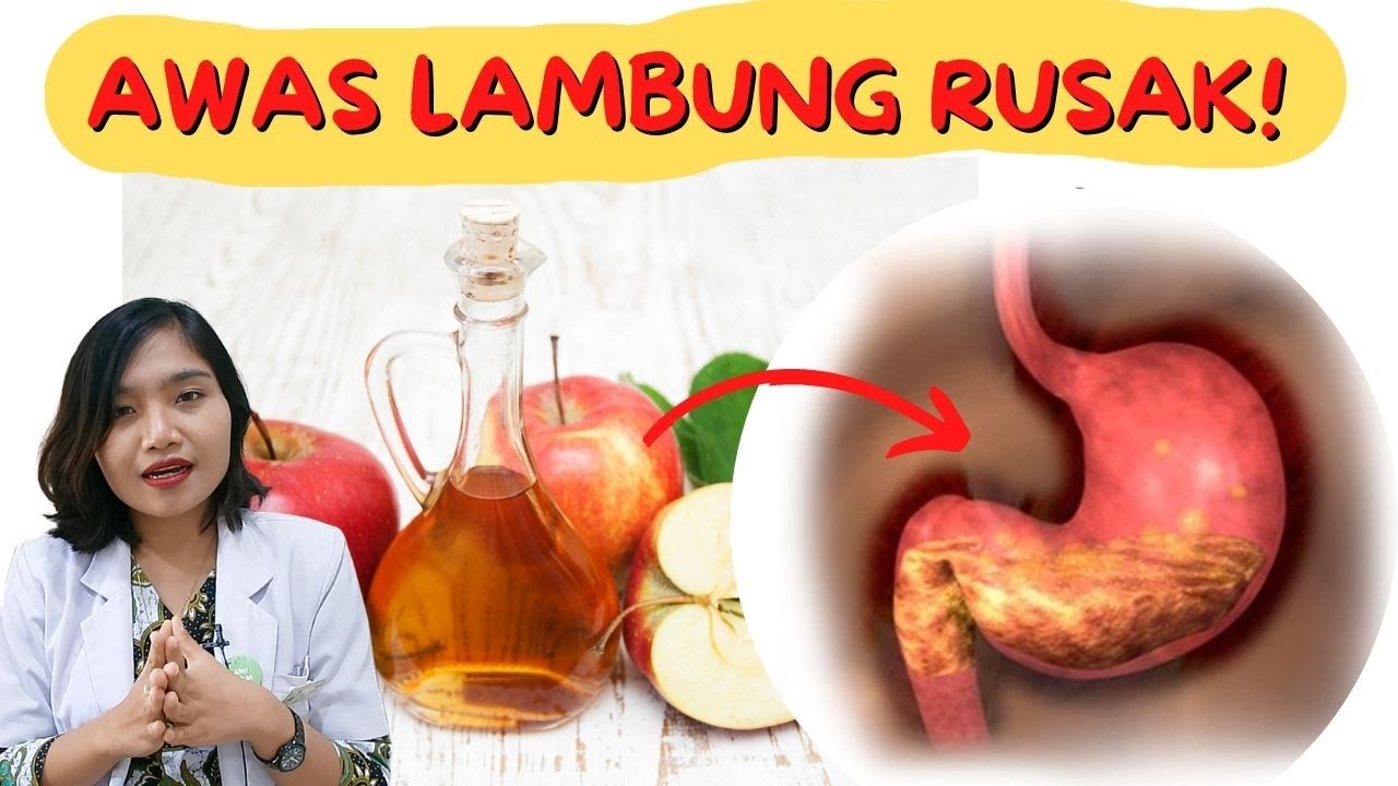 ФАКТЫ И МИФЫ ПОЛЬЗА ЯБЛОЧНОГО УКСУСА! ОСТОРОЖНО, ПОВРЕЖДЕНИЕ ЖЕЛУДКА!