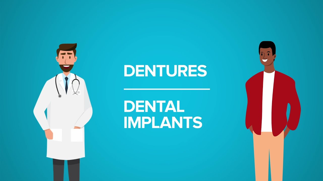 Implants vs Dentures