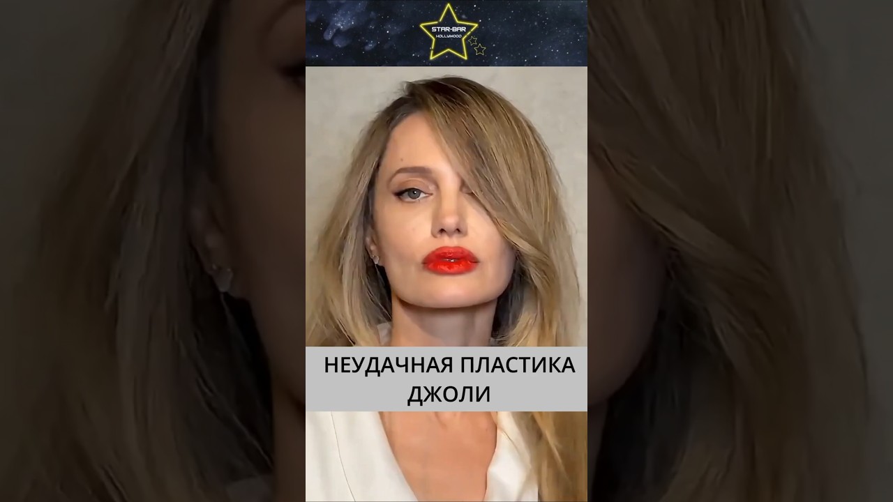Джоли сделала НЕУДАЧНУЮ ПЛАСТИКУ