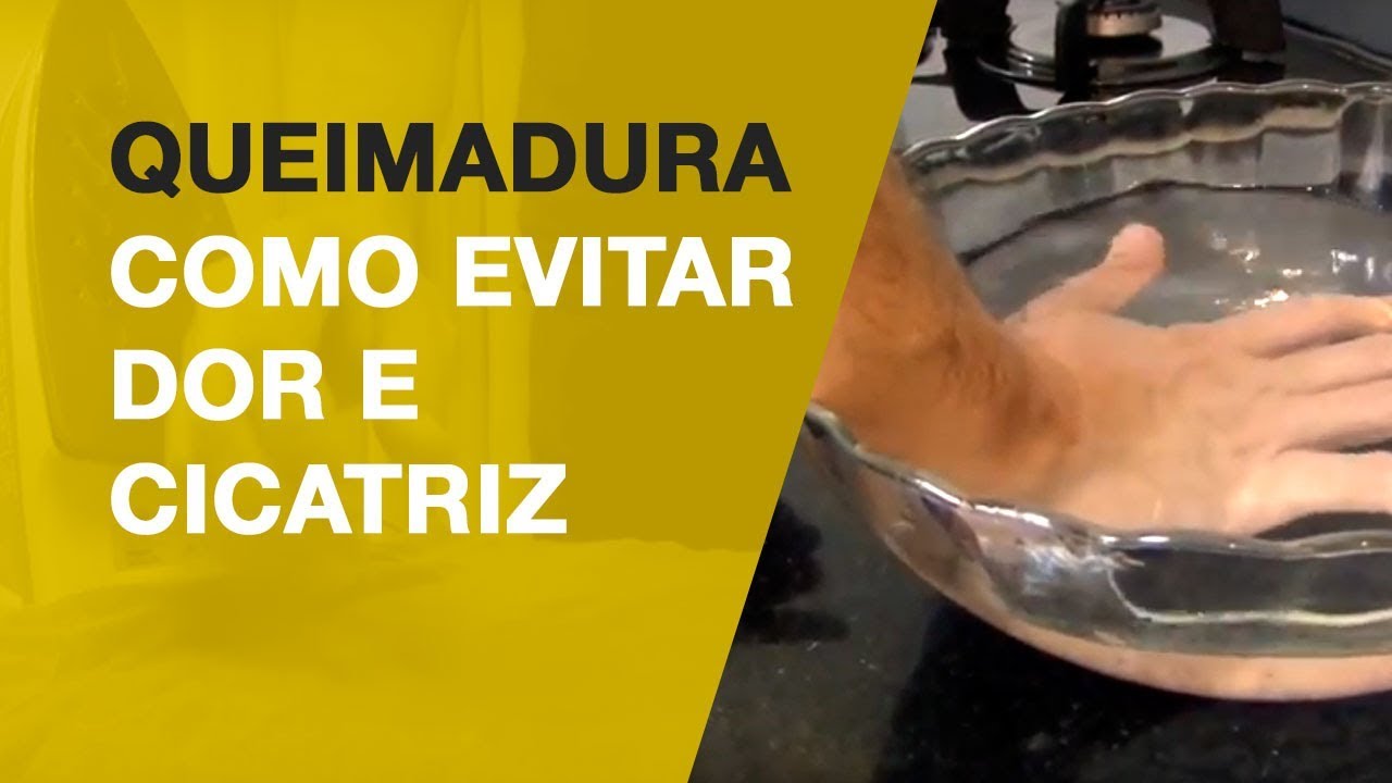 COMO NÃO SENTIR DOR APÓS QUEIMADURAS