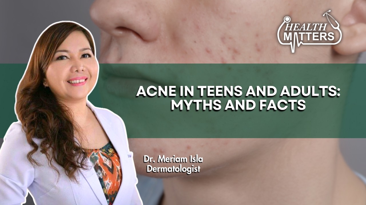 Acne in Teens and Adults: Myths and Facts | Health Matters | February 16, 2026