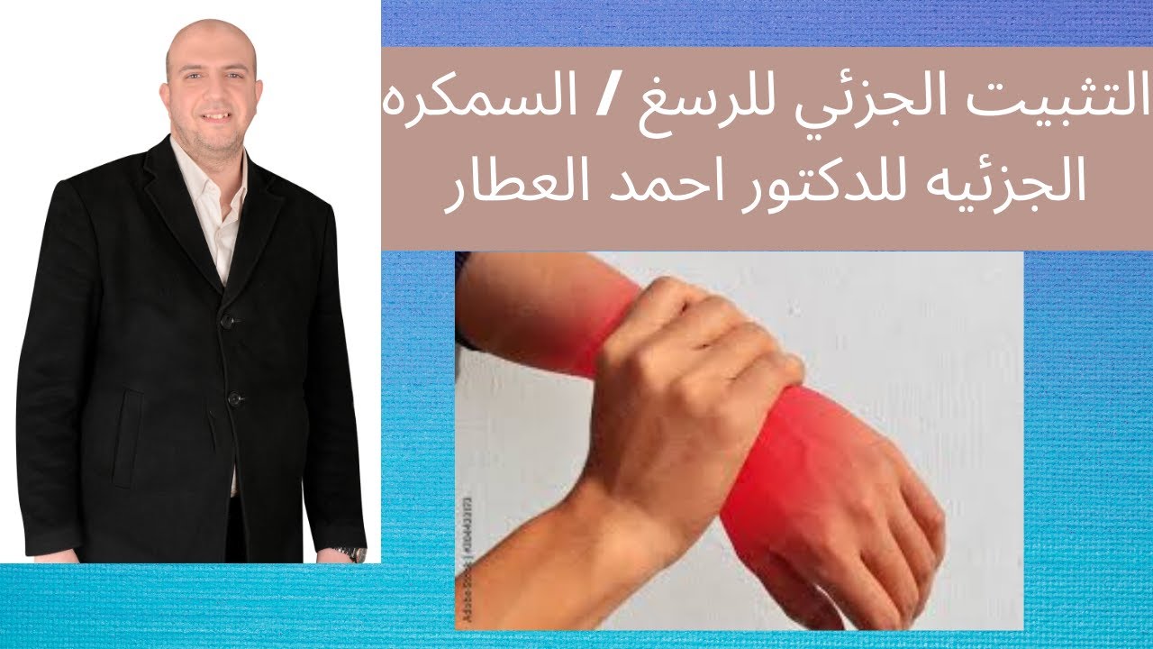 التثبيت الجزئي للرسغ/ السمكره الجزئيه للدكتور احمد العطار