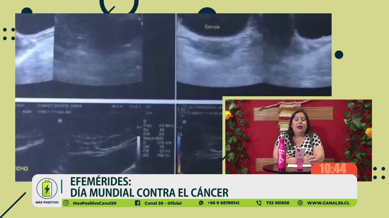MÁS POSITIVO - DÁ MUNDIAL CONTRA EL CÁNCER (4 DE FEBRERO)