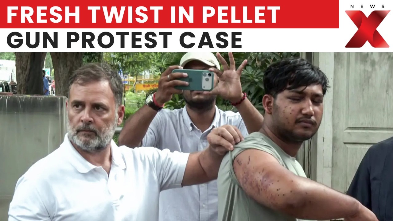 Supreme Court On CJP Protest Case: Pellet Gun Allegations, Police Action Row Explained