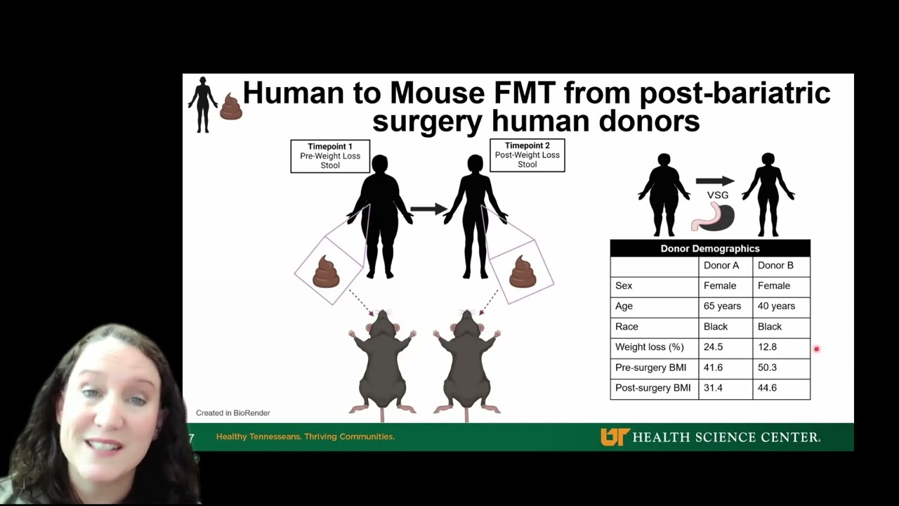 Breast cancer immunotherapy is enhanced by the gut microbiome following bariatric surgery