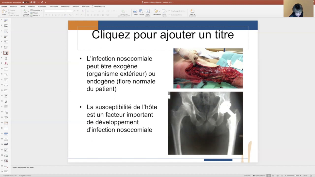 Médico Légal & IOA, Dr Laurence Maulin