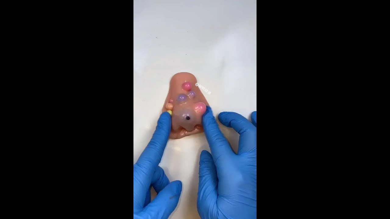 Your nose after the holiday #decompression squeeze acne #decompression toys