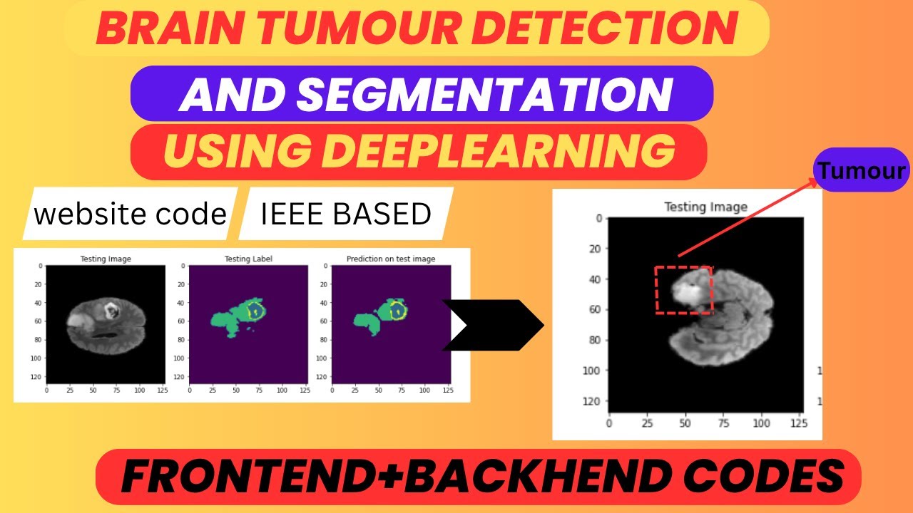 Brain tumor Detection Using Deep learning | Best IEEE AI Project 2025-2026