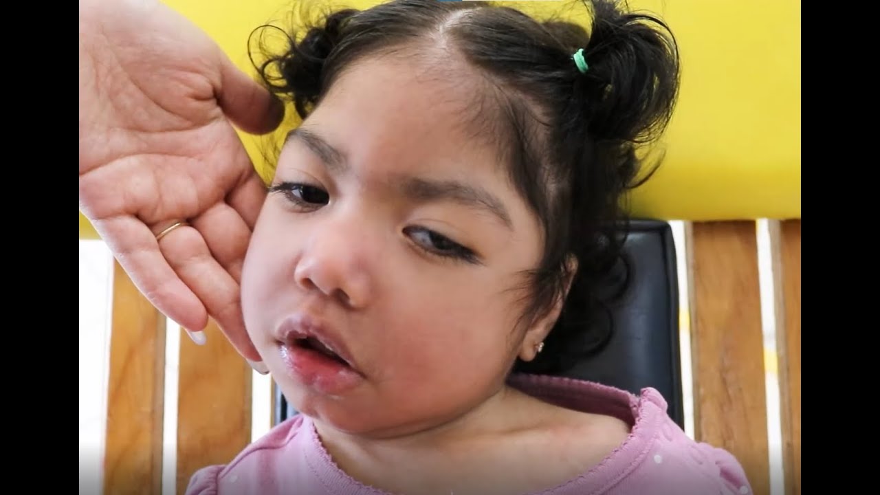 Hermoso Testimonio de Ana Victoria, una pequeña con Parálisis Cerebral.