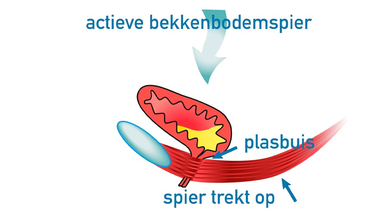 Stressincontinentie? Gebruik je bekkenbodem!