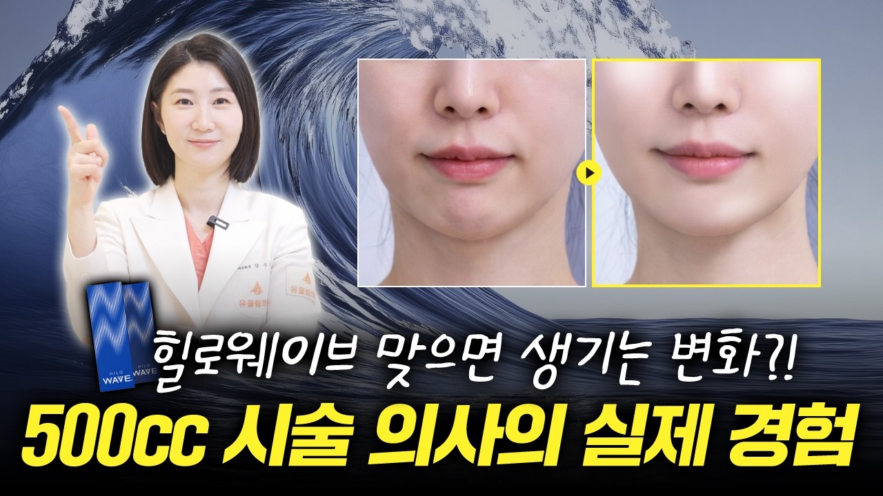 모르면 손해!500cc이상 시술한 의사가 말하는 힐로웨이브 맞으면 생기는 변화|힐로웨이브 |수분스킨부스터|피부결|잔주름|피부속광|물광주사#skincare