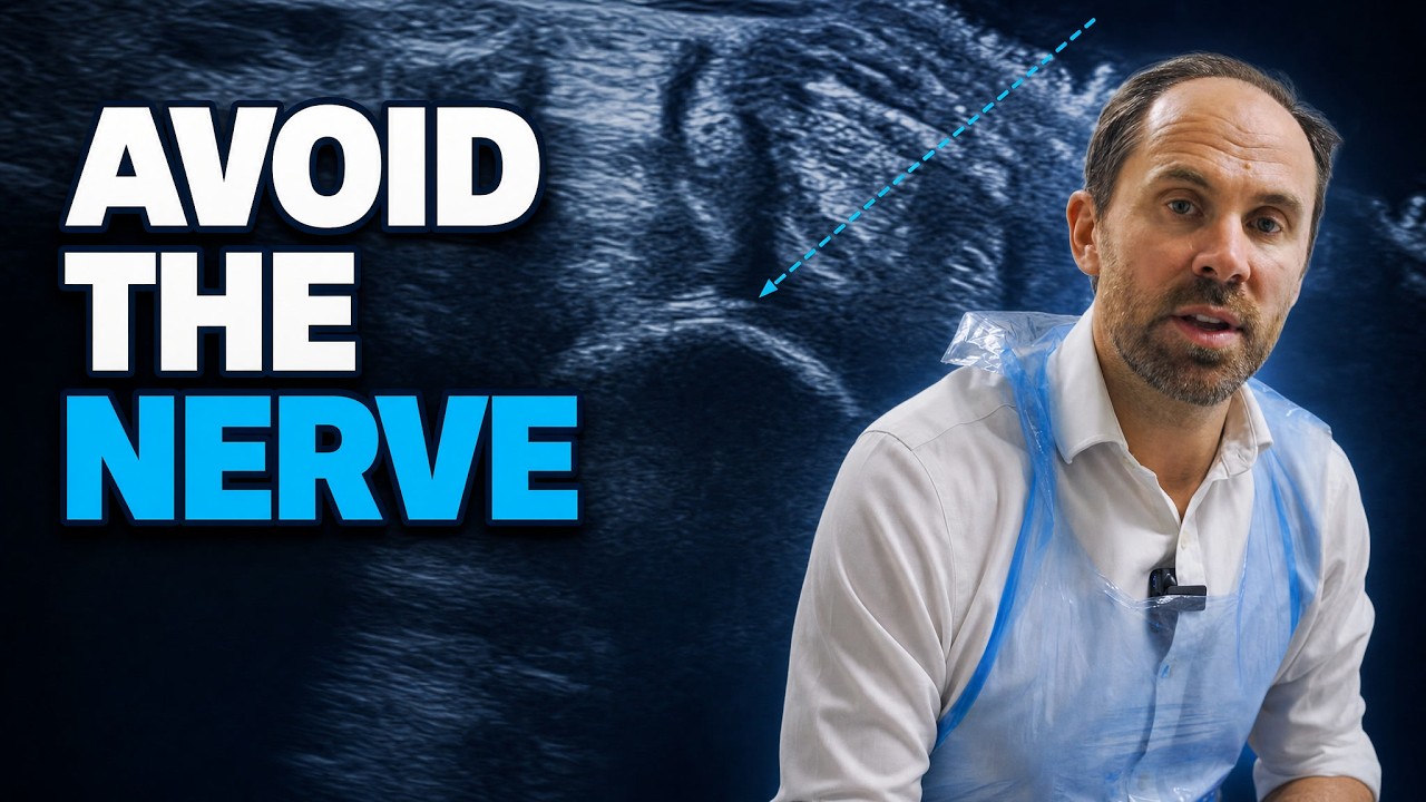 Master Carpal Tunnel Injections with Ultrasound: A Step-by-Step Guide!